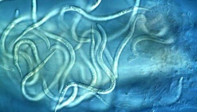 what nematode parasites look like in the human body