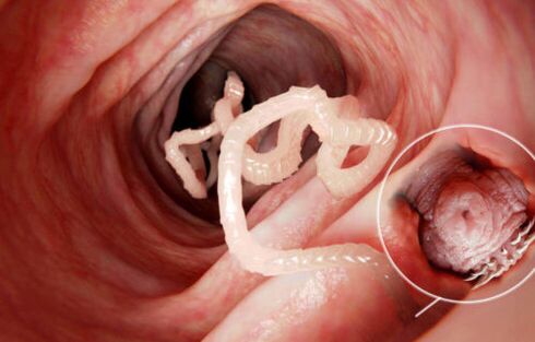 the worm is a parasite in the human body
