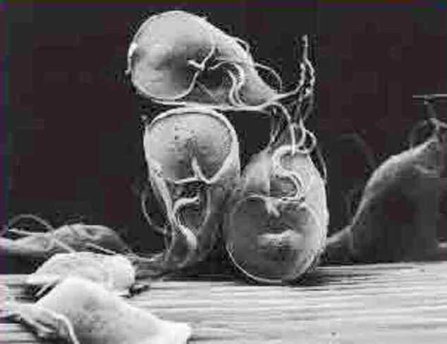 protozoan parasites giardia